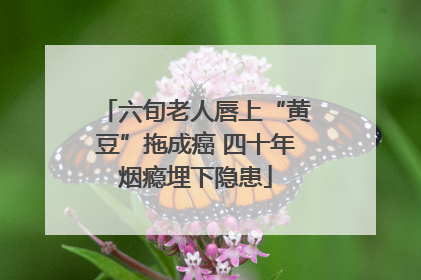 六旬老人唇上“黄豆”拖成癌 四十年烟瘾埋下隐患